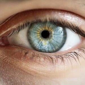 Cat Eye syndrome is characterized by two main features