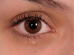 How is dry eye diagnosed?