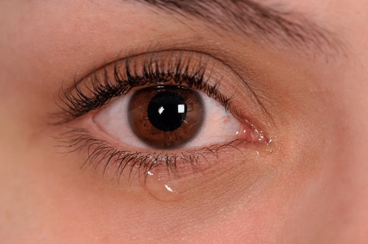 How is dry eye diagnosed?